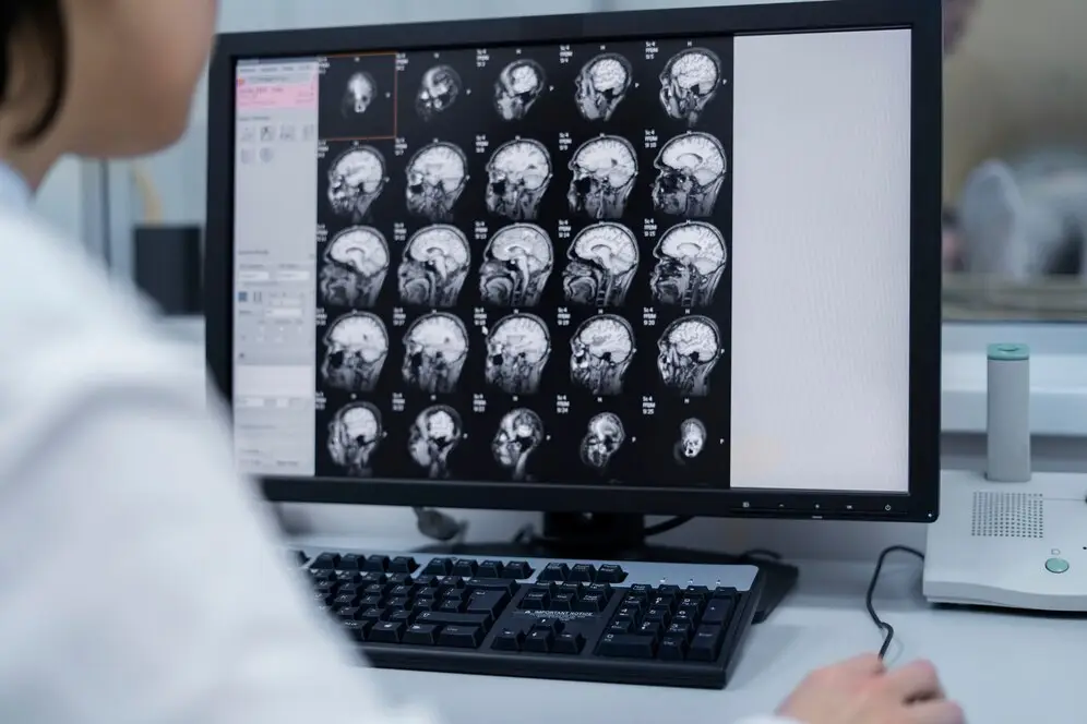 A foto mostra uma médica examinando imagens de ressonância magnética do cérebro em um monitor de computador. O monitor exibe várias seções transversais do cérebro em preto e branco.